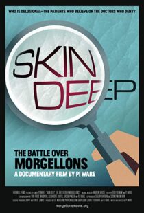 دانلود مستند Skin Deep: The Battle Over Morgellons 2019104233-1139785522